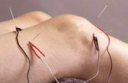 Electro-acupuncture treatment on a knee.